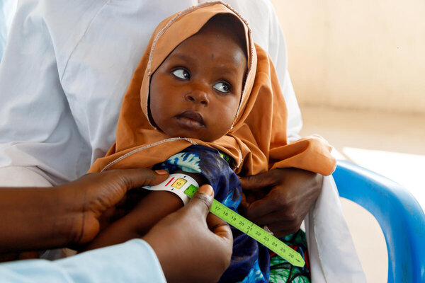 WFP/Nommiyid Chantu. A mother accesses treatment for her baby's Moderate Acute Malnutrition (MAM) at a WFP supported nutrition clinic at the 1000 IDP Camp Dikwa Borno Northeast Nigeria. A MUAC screening of 12 on the yellow scale shows Zainab has MAM