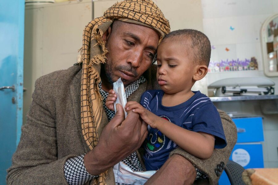 アラファトの末息子であるスルタンは、重度の急性栄養失調の治療を受けなければなりませんでした。Photo: WFP/Mohammed Awadh
