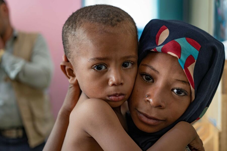イエメンの子どもたちのほぼ半数が栄養失調の結果として発育不全になっています。 Photo: WFP/Mohammed Awadh
