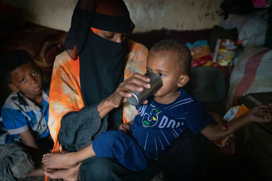 オム・スルタンは、栄養失調で子どもを失うのではないかと心配していました。360,000人のイエメンの子どもたちは、治療を受けないと命を落とす危機にさらされています。 Photo：WFP/Mohammed Awadh
