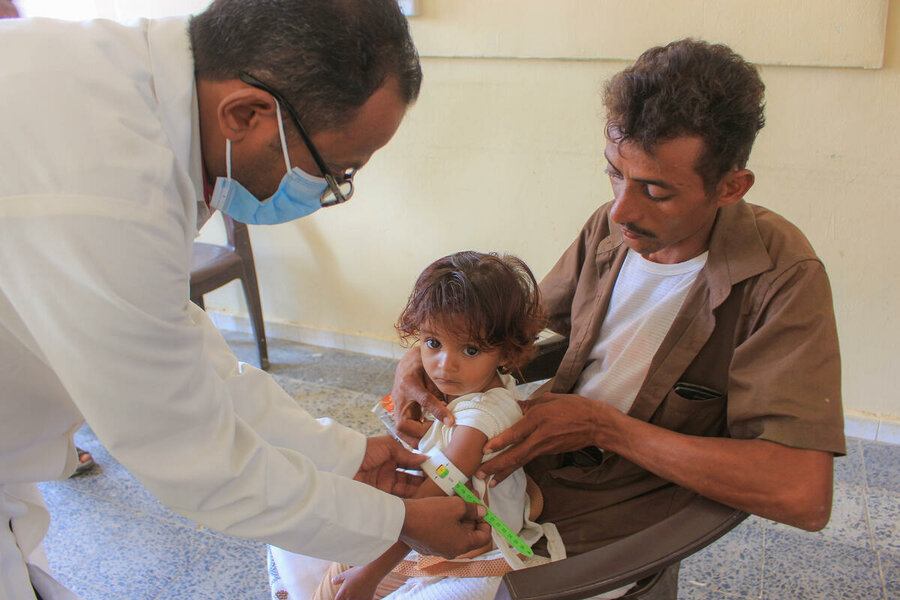 イエメン：ハッジャーにあるWFPが支援するクリニックで、中等度の急性栄養不良と診断される子ども。Photo: WFP/Issa Al-Ragh