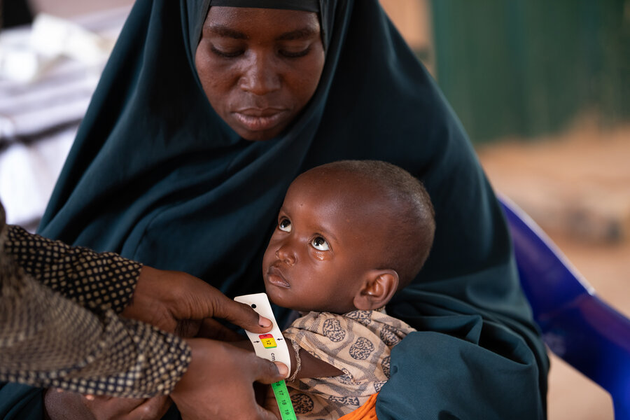 A mother holds a baby while it is checked for malnutrition