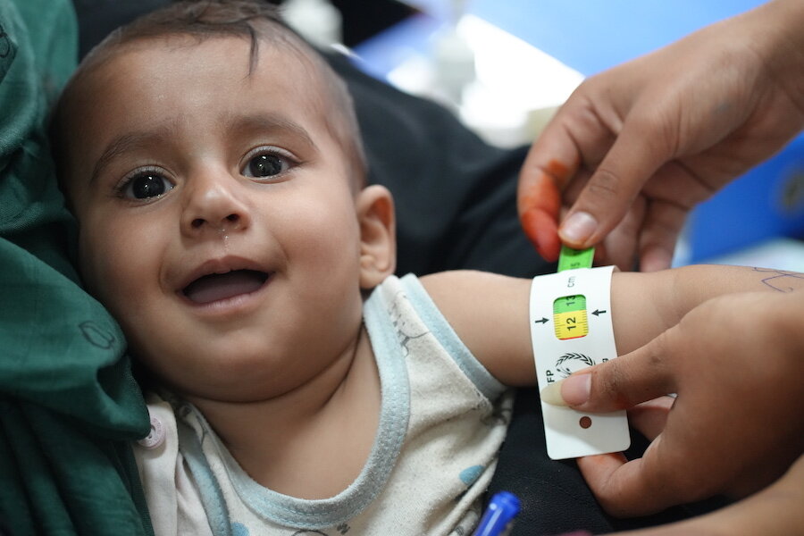アフガニスタン・カブールの病院で、栄養状態を調べるために生後9ヶ月の女児の上腕囲を測定しています。