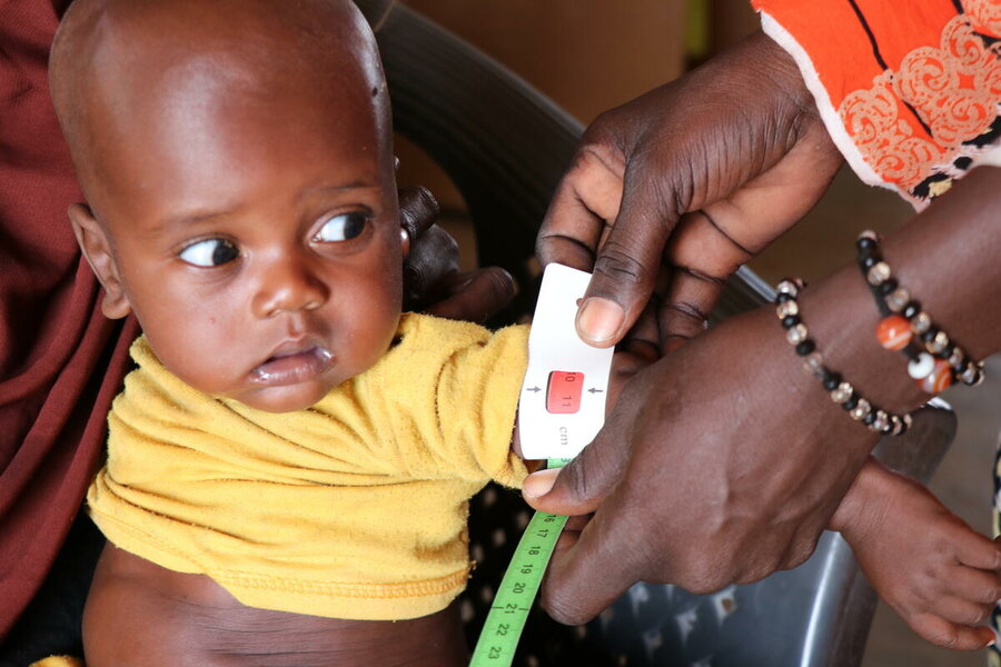 チャド:国連WFPが支援するチウォルウ保健センターで、子どもの栄養不良をチェックしています。赤の測定値は重度の栄養不良を示しています。A child is checked for malnutrition at the WFP-supported Tchiworou Health Center. The red measurement indicates severe malnutrition. Photo: WFP/Amadou Baraze