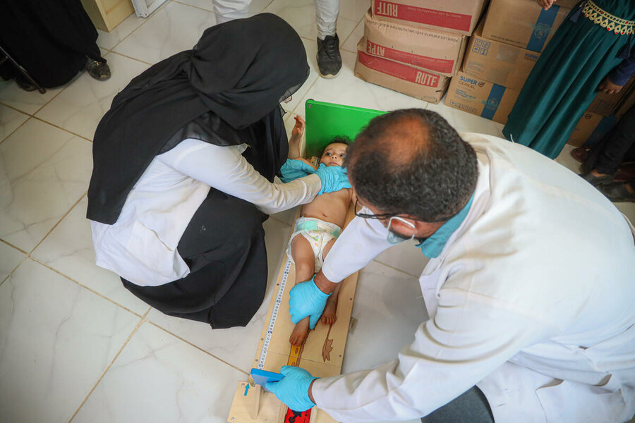 イエメン:タイズ県の医療従事者が、栄養不良から回復しつつあるバスマ・モフィードちゃんの発育状況を確認します。Photo: WFP/Al Baraa Mansoor