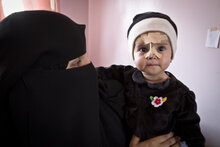 イエメン：飢きん防止に向け一刻も早い支援を